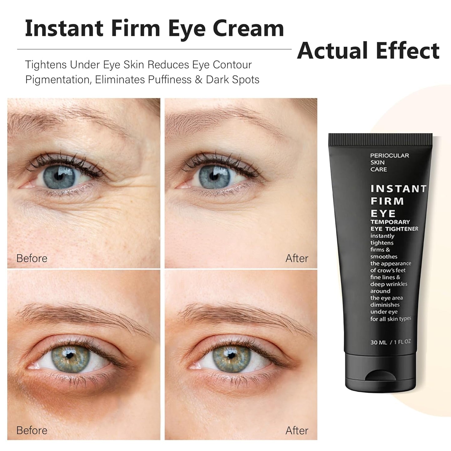 Instant Temporary Eye Tightener : Instant eye cream Reduces UnderEye Bags, Dark Circles & Puffiness, Anti Aging Fine Lines, Firm That Delicate Skin Under Your Eyes 1 oz tube